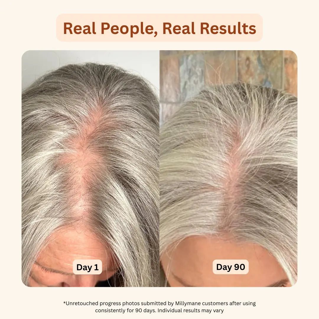 Hair, Skin & Nails Gummies - millymane