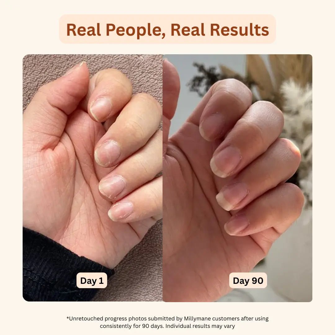 Hair, Skin & Nails Gummies - millymane