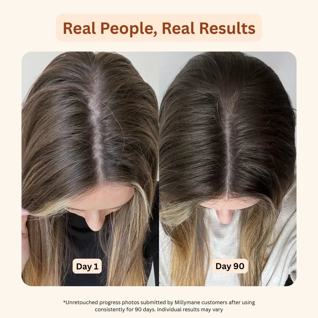 Hair, Skin & Nails Gummies - millymane